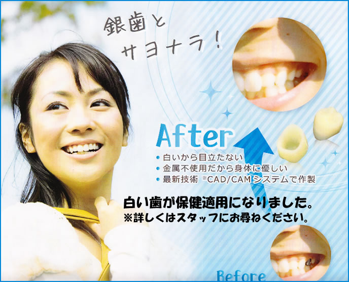白い歯保健適用